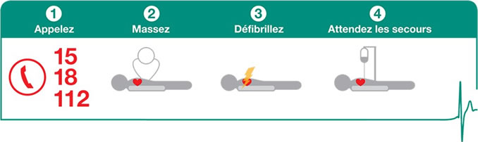 Consignes d'utilisation d'un défibrillateur